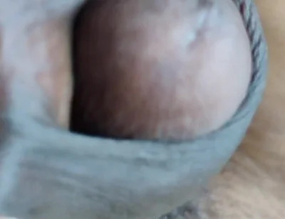 My Penis