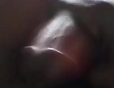 Sperm