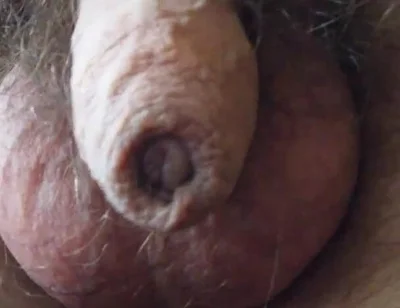 My Penis Walkabout