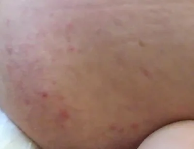 More Hotel Fun