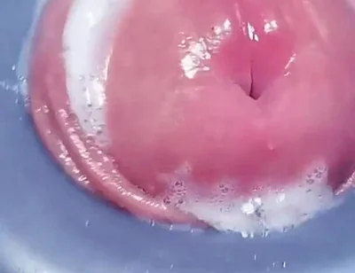 Penis Machine with a New Attachment