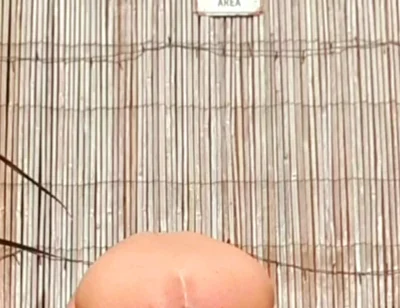 Anal Stretching