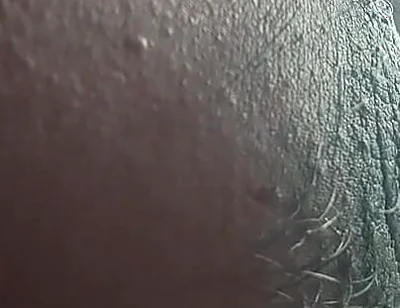Armpit