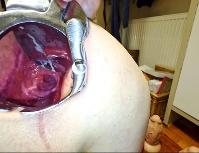 Extreme Anal Speculum Opening My Anal Canal!