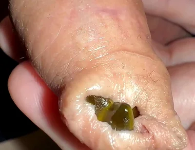 Juicy Small Cock Foreskin Games