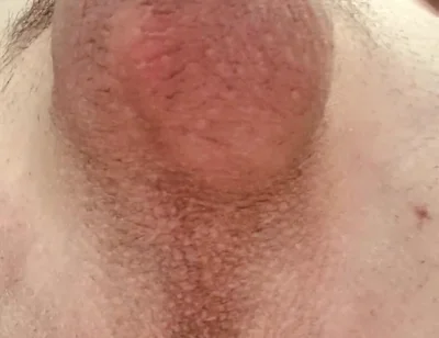 Do You Like Shaved or Hairy?
