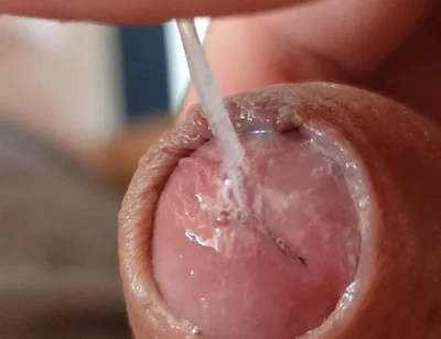Juice From the Glans When Excited to the Extreme.