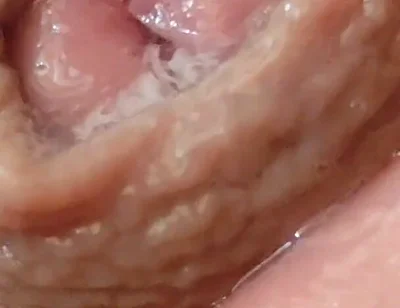 Juice From the Glans When Excited to the Extreme.