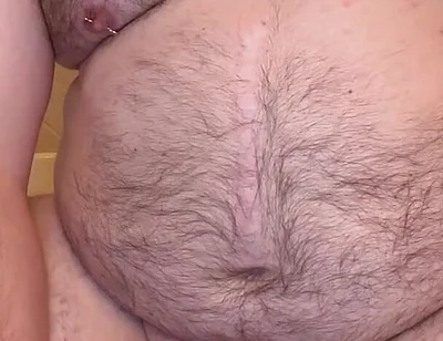 Pierced Chubby Guy Sounding with 3mm - 4mm and 5mm - 6mm Hegar