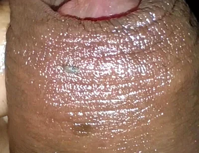 Close-up of Foreskin and Ejaculation in My Pants
