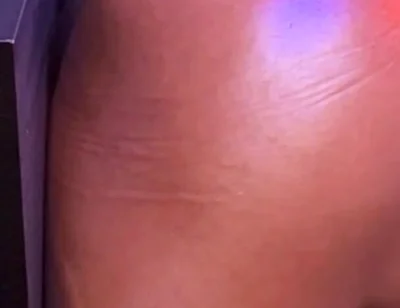 Bubble Butt