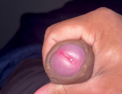 My Penis
