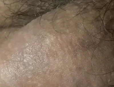 He Is Waking up