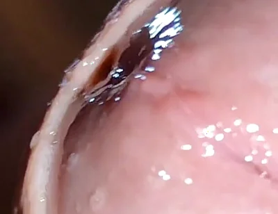 Glans Eye Watering After Intense Fucking.