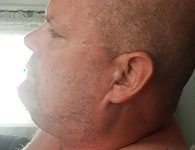 Renewed Destruction of the Bitch