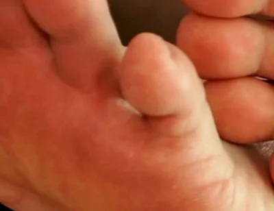 The Foot Master's Installation Protocol