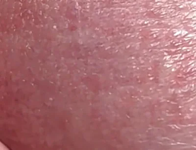 Sperm Close-up Front
