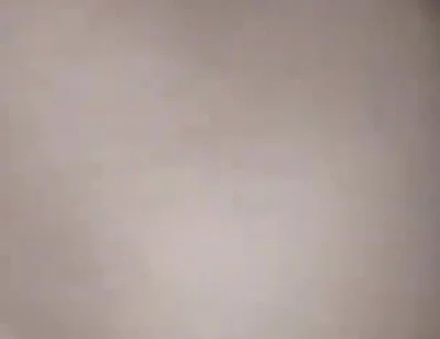 Destroying the Asshole on the Dick