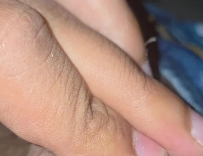 Closeup
