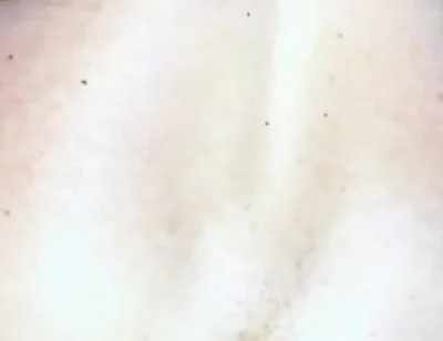 Extreme Anus Gape