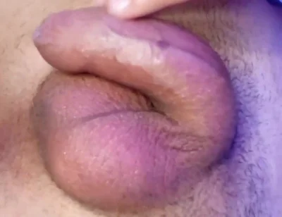 Masturbation