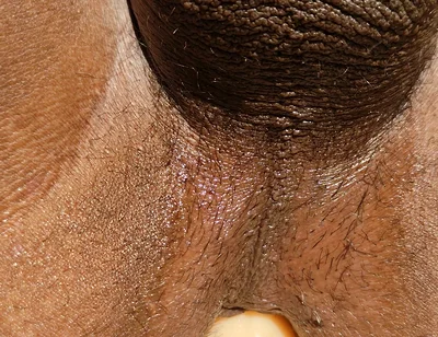 I Have a Very Hot Ass