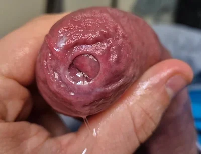 Uncut Head Precum Play