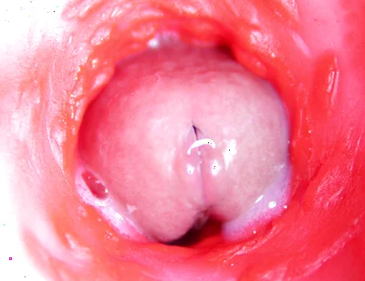 Camera Inside Anal: Almost Cum in Ass! Best Internal Asmr in 4K