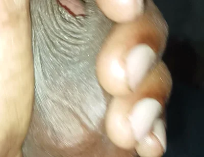Masturbation