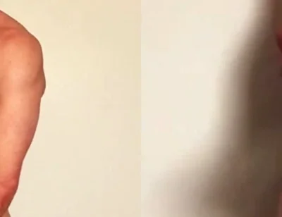 Masturbation