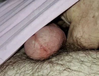 Pissing Alot in Warm