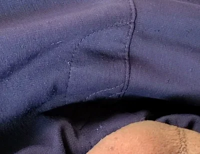 Sucked by Mosquito