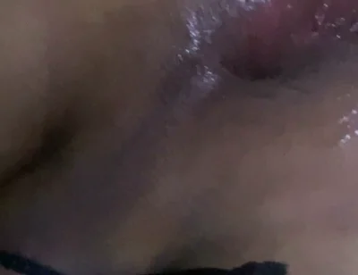 Surprise
