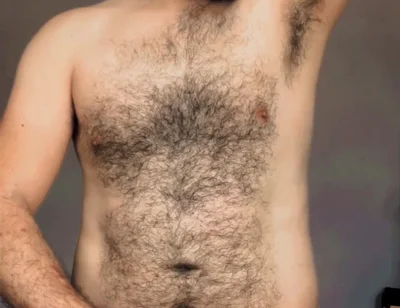 May Hairy Males Be Eternal