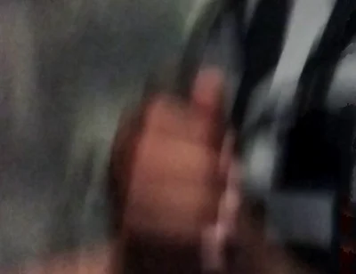 My Hand Exploded When Exposed to Masturbation