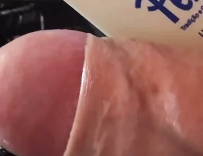 Extreme Detachment of Phimosis with Natural Oil,.