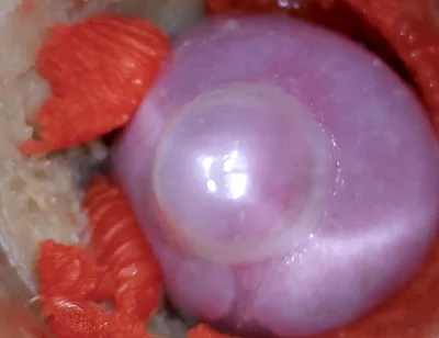 The Camera Inside the Deep Pussy Records a Huge Ejaculation with a Stuck Condom 4K