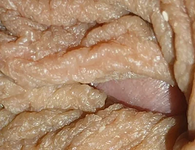 The World's Largest Foreskin Opening and Closing.