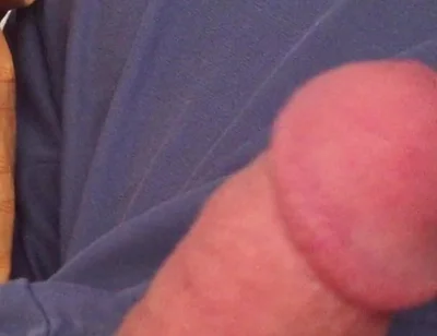 Surprise Dick