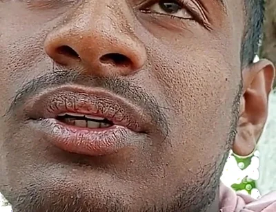 How to Lengthen the Penis but Should Shake the Day