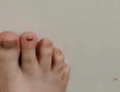 11-26-2025 Cute Little Toes