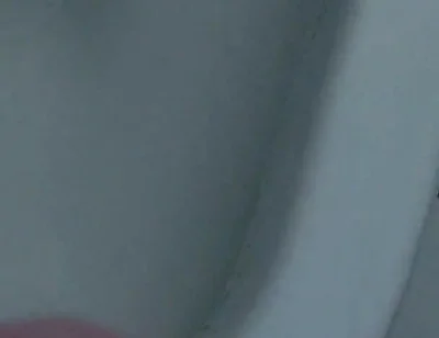 Homemade Method for Freezing the Penis.