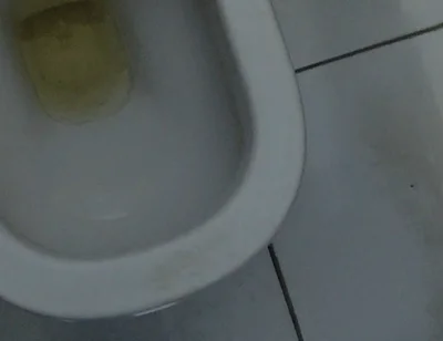 Homemade Method for Freezing the Penis