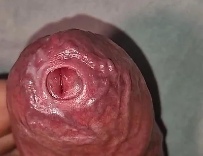 Close up on Phimosis Large Cock, so Hot!