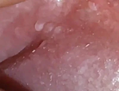 Super Daddy Enlarged Hole Pulsing with Horniness.