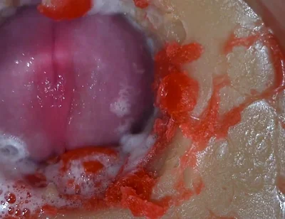 Insemination - Internal Camera Captures Deep Male Ejaculation