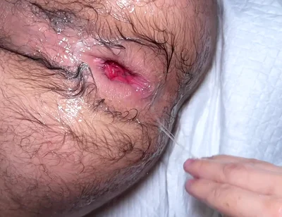 Masked Fister X Fisting Ffunantoni