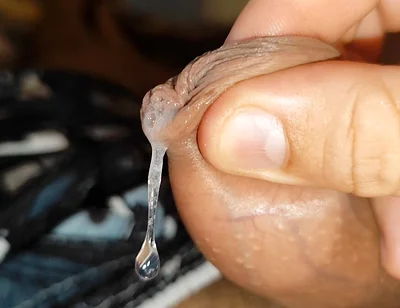 Cumshot of the Largest Phimosis Foreskin in the World.